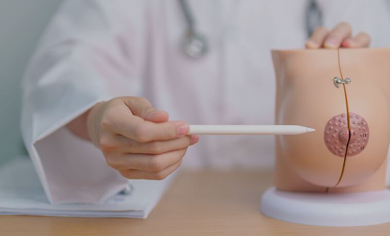 Mammogram procedure