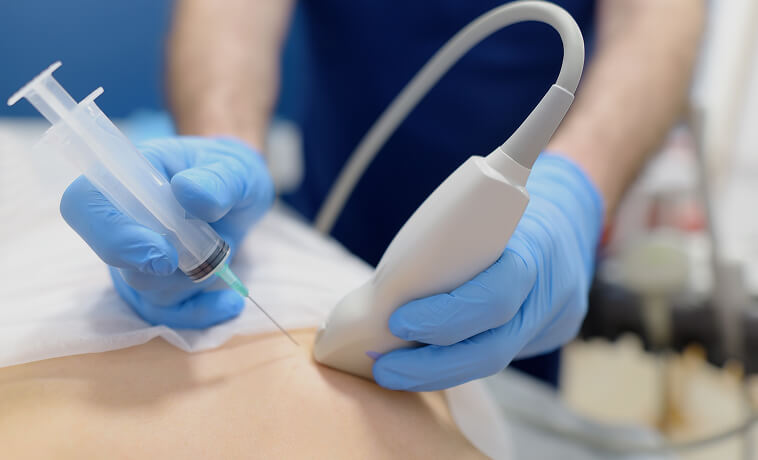Mammogram procedure