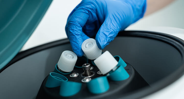 Onco Fertility Preservation