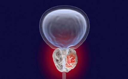 Navigating Medical Oncology Treatments for Prostate Cancer: A Comprehensive Guide