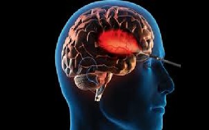 The Rise of Keyhole Brain Surgery: How It’s Changing Neurosurgery