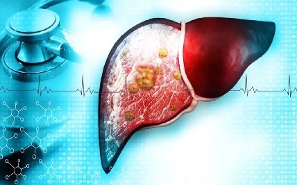 Treatment Options for Liver Cancer: From Chemotherapy to Targeted Therapy