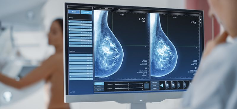 How is Radiation Therapy Used to Treat Breast Cancer?