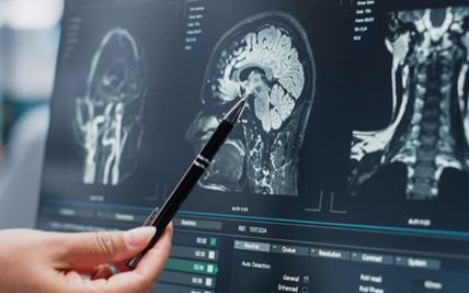 Role of Neurosurgery in the Treatment of Traumatic Brain Injuries