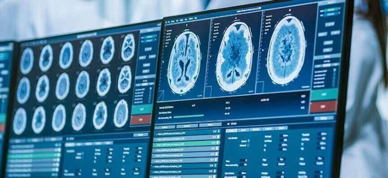 Oncological Imaging 