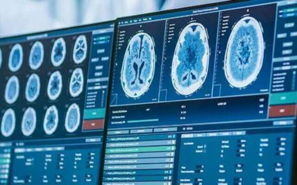 Oncological Imaging 