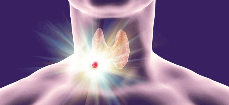 Thyroid Cancer