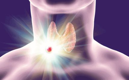 Thyroid Cancer
