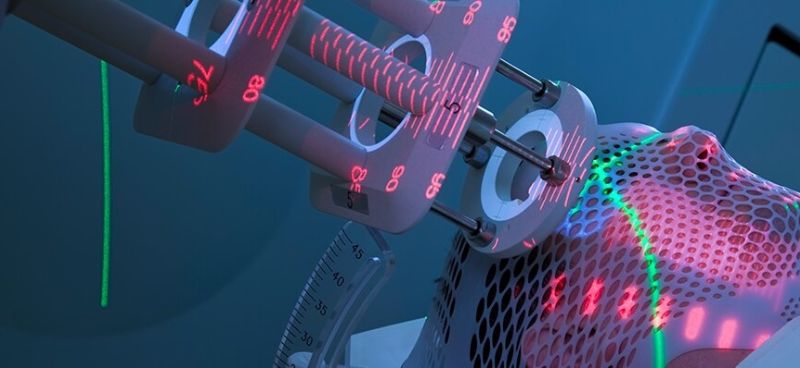 Spatially Fractionated Radiation Therapy