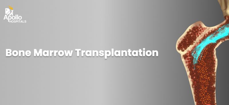 Bone Marrow Transplant (BMT) - Types, Indications, Procedure, Cost in India, Risks, Recovery and Benefits