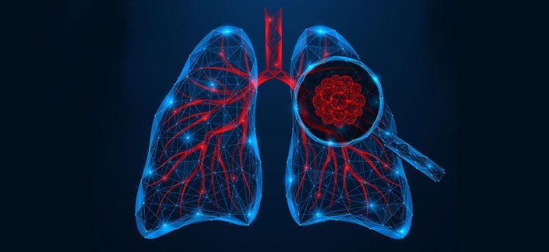 Lung Cancer