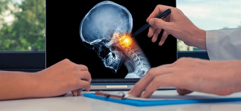 Head and Neck Cancer