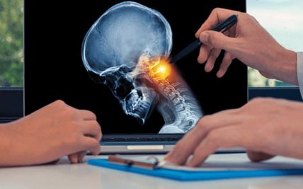 Head and Neck Cancer