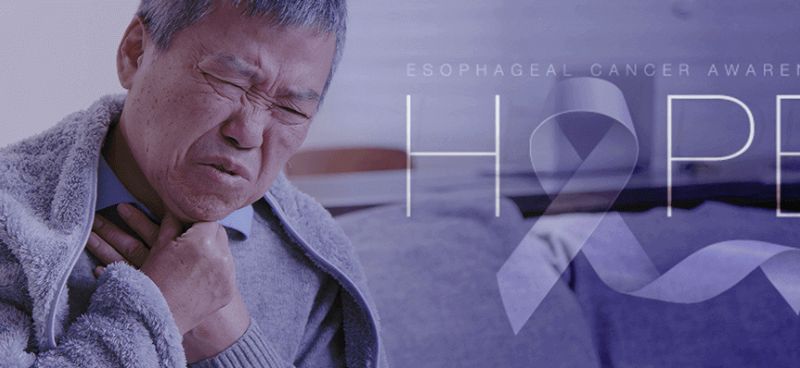 Oesophageal Cancer 