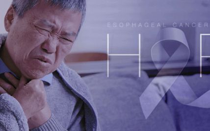 Oesophageal Cancer 