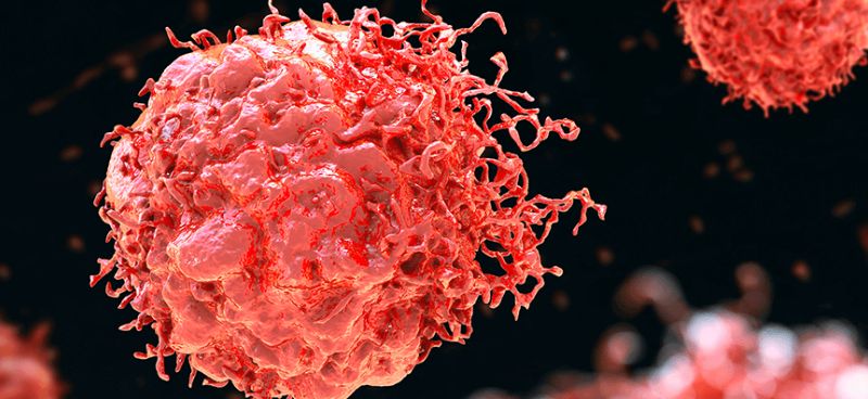 Genetic Factors and Gastrointestinal Stromal Tumors: What You Need to Know
