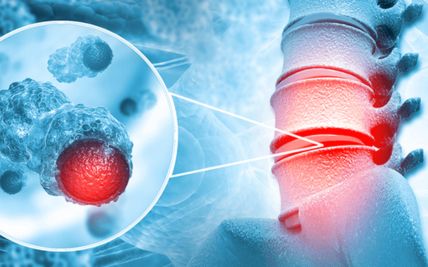 Pediatric Sarcoma and Bone Cancer: Unique Challenges and Treatment Approaches