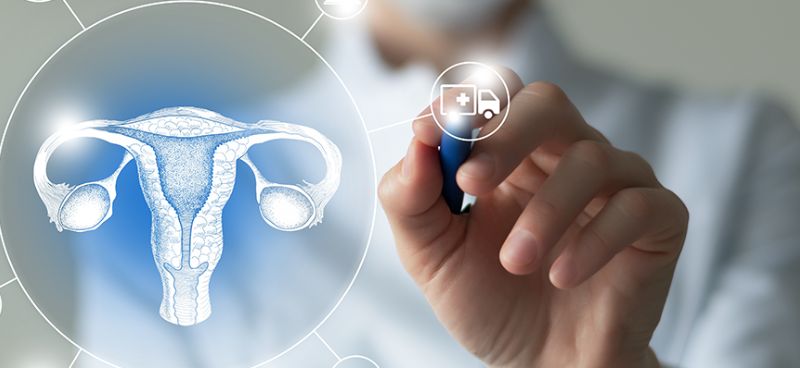 Unusual Symptoms of Ovarian Cancer and When to Seek Care