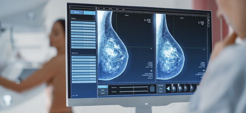 5 Breakthroughs in Breast Cancer Treatments