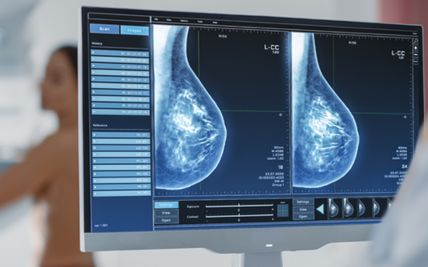 5 Breakthroughs in Breast Cancer Treatments