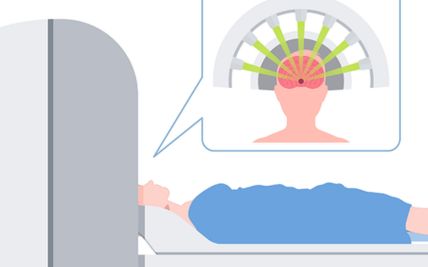 Understanding Radiosurgery or Stereotactic Radiosurgery for Precise Brain and Spine Treatment