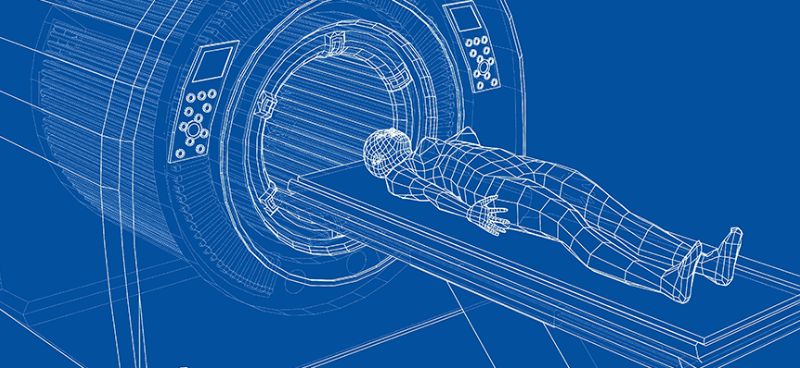Stereotactic Body Radiotherapy (SBRT): Advancements in Precise and Targeted Cancer Treatment