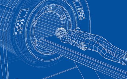 Stereotactic Body Radiotherapy (SBRT): Advancements in Precise and Targeted Cancer Treatment