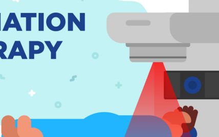 Enhancing Precision in Cancer Treatment: The Power of Image-Guided Radiation Therapy (IGRT)