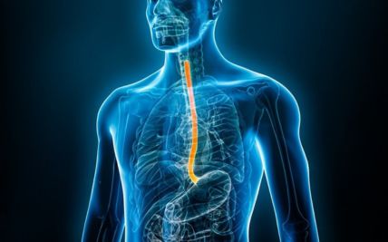 Esophageal Cancer