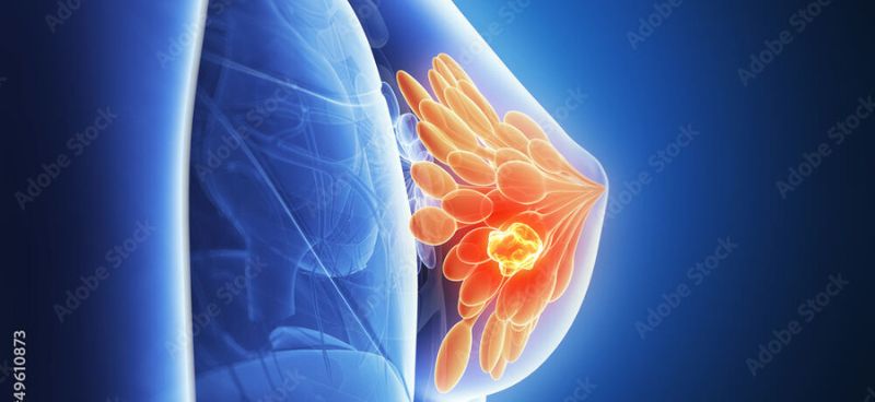 Women’s Health Matters