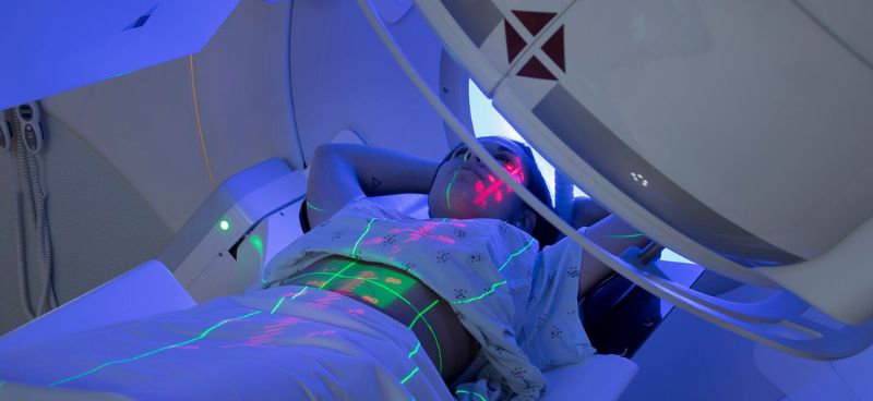 Radiation Therapy in Pancreatic Cancer
