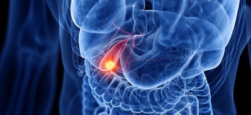 Early Warning Signs of Gallbladder Cancer: Recognizing Symptoms and Seeking Timely Diagnosis