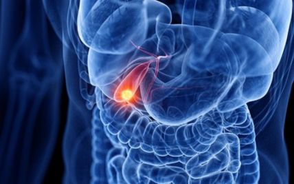 Early Warning Signs of Gallbladder Cancer: Recognizing Symptoms and Seeking Timely Diagnosis