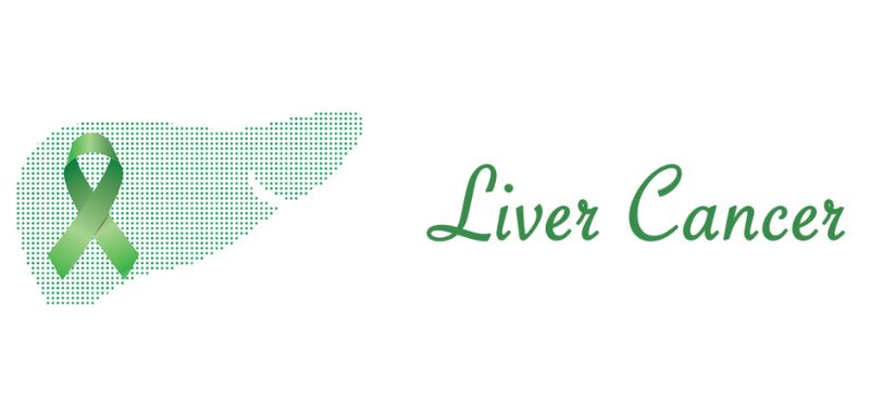 Liver Cancer - Types, Symptoms, Causes Risks, Diagnosis, Treatment and Prevention