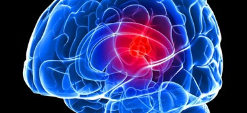 Early Warning Signs of Glioblastoma: Recognizing Symptoms and Seeking Timely Diagnosis