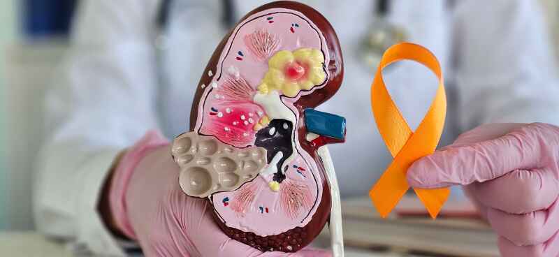 Early Warning Signs of Kidney Cancer: Recognizing Symptoms and Seeking Timely Diagnosis