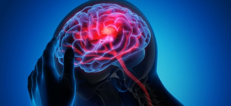 Surgical Management for Stroke