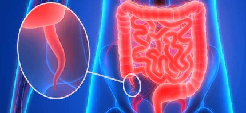 Early Warning Signs of Appendix Cancers: Recognizing Symptoms and Seeking Timely Diagnosis
