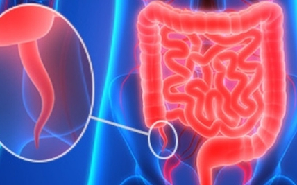 Early Warning Signs of Appendix Cancers: Recognizing Symptoms and Seeking Timely Diagnosis