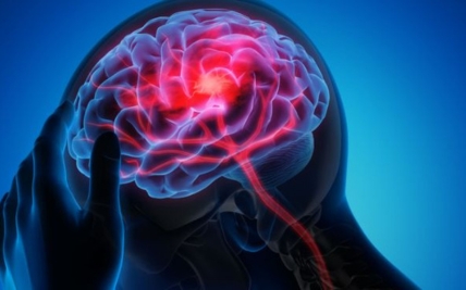 Surgical Management for Stroke