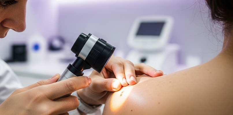 Skin Cancer