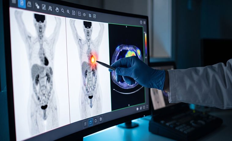 PET-CT