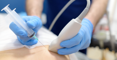 Lymph-Node Surgery