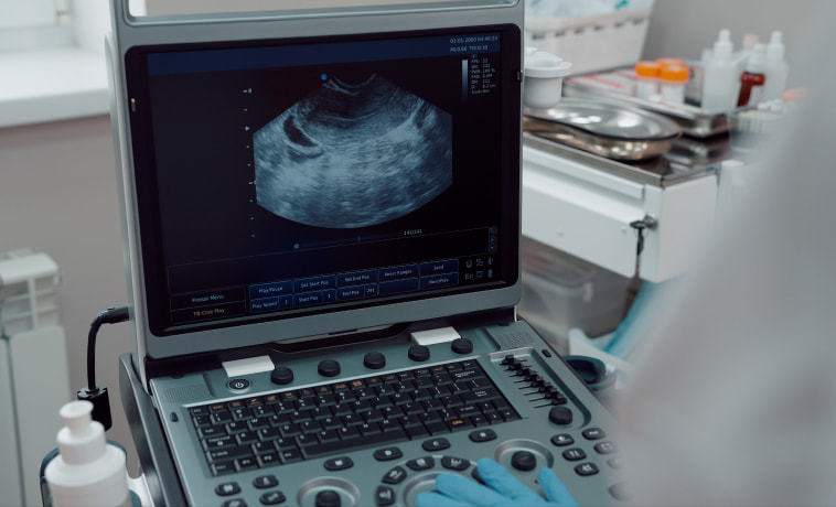 Endorectal Ultrasound