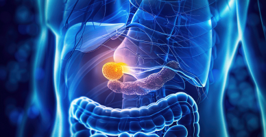 Distal Pancreatectomy