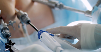 Endoscopic Resection