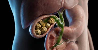 Gallbladder and Bile Duct Surgery