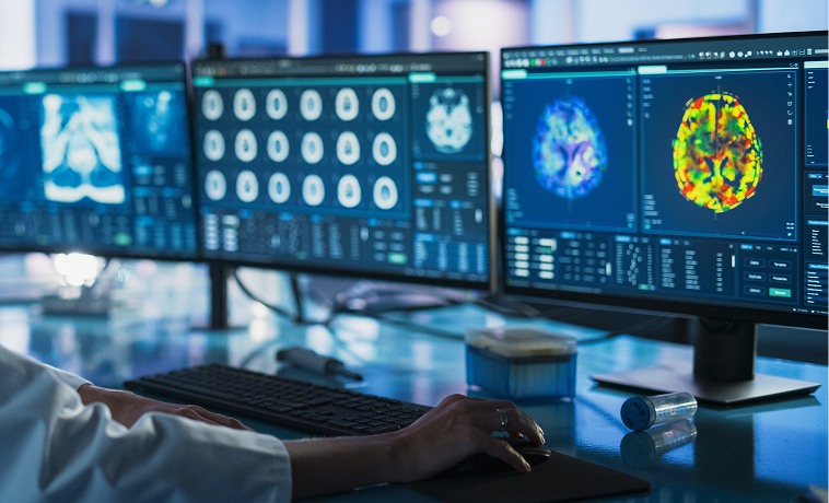 PET-CT
