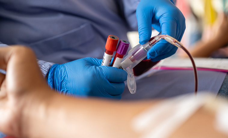 EBV Testing