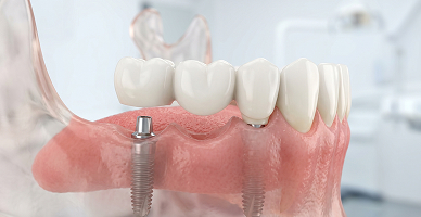 Mandibular and Maxillary